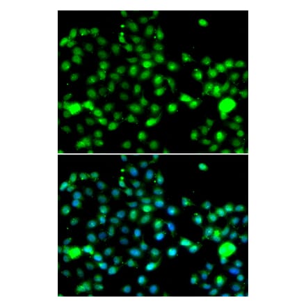 Immunofluorescence - Anti-IP6K2 Antibody (A91975) - Antibodies.com