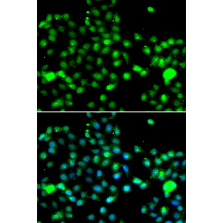 Immunofluorescence - Anti-IP6K2 Antibody (A91975) - Antibodies.com