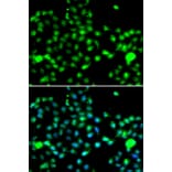 Immunofluorescence - Anti-IP6K2 Antibody (A91975) - Antibodies.com