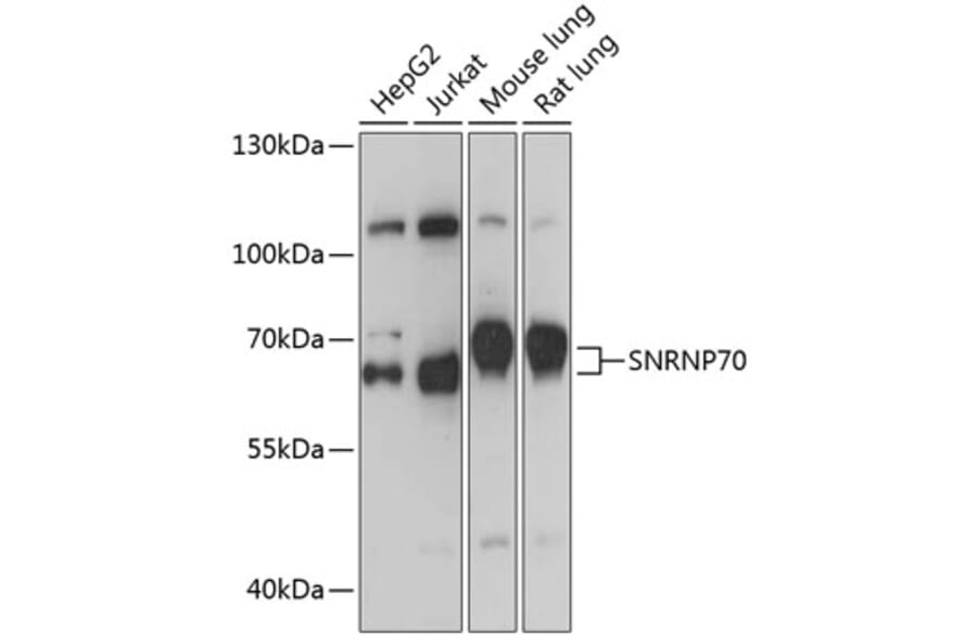 Western Blot - Anti-SNRP70/U1-70K Antibody (A91976) - Antibodies.com