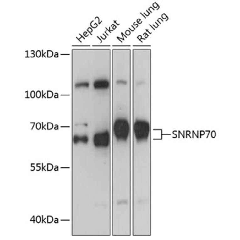 Western Blot - Anti-SNRP70/U1-70K Antibody (A91976) - Antibodies.com