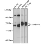 Western Blot - Anti-SNRP70/U1-70K Antibody (A91976) - Antibodies.com