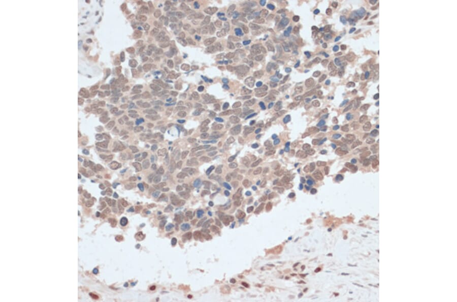 Immunohistochemistry - Anti-ZNF562 Antibody (A91977) - Antibodies.com