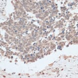 Immunohistochemistry - Anti-ZNF562 Antibody (A91977) - Antibodies.com