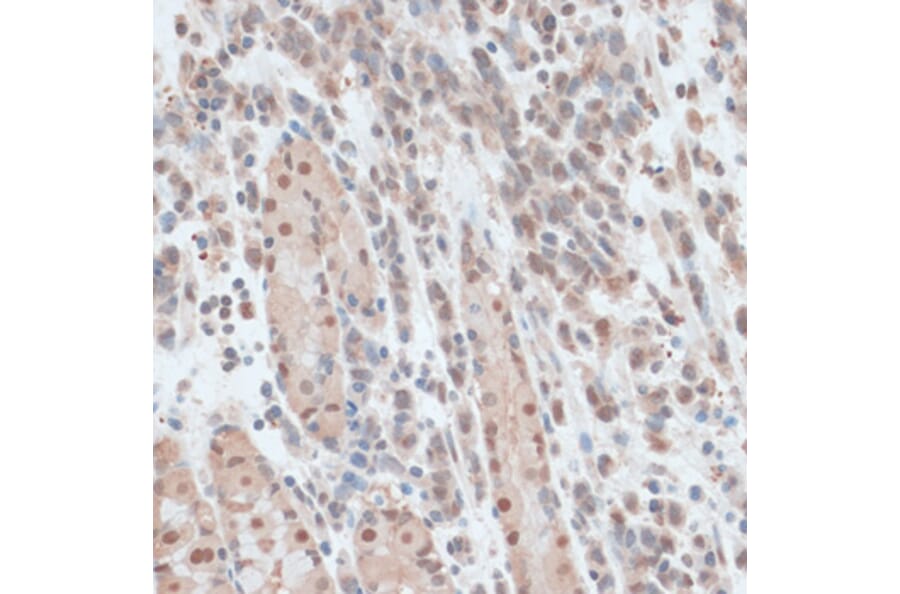 Immunohistochemistry - Anti-ZNF562 Antibody (A91977) - Antibodies.com