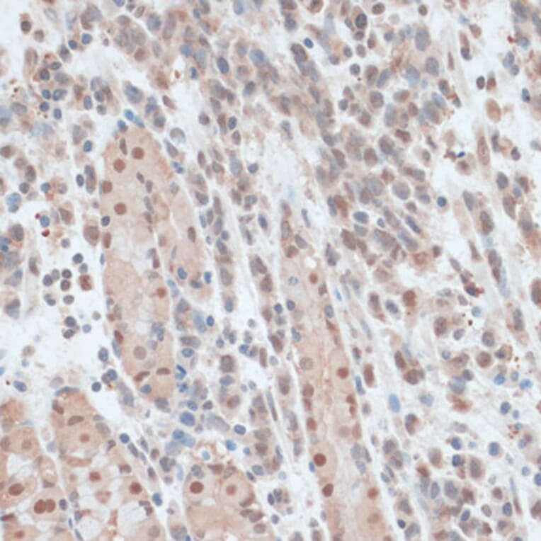 Immunohistochemistry - Anti-ZNF562 Antibody (A91977) - Antibodies.com