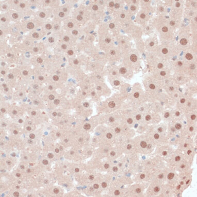 Immunohistochemistry - Anti-ZNF562 Antibody (A91977) - Antibodies.com