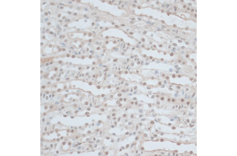 Immunohistochemistry - Anti-ZNF562 Antibody (A91977) - Antibodies.com