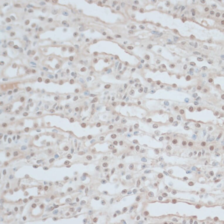 Immunohistochemistry - Anti-ZNF562 Antibody (A91977) - Antibodies.com