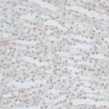 Immunohistochemistry - Anti-ZNF562 Antibody (A91977) - Antibodies.com