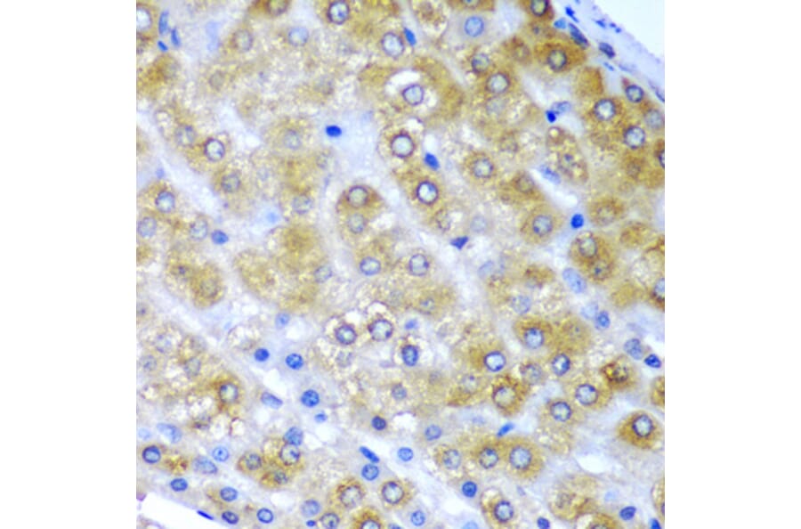 Immunohistochemistry - Anti-BMF Antibody (A12907) - Antibodies.com
