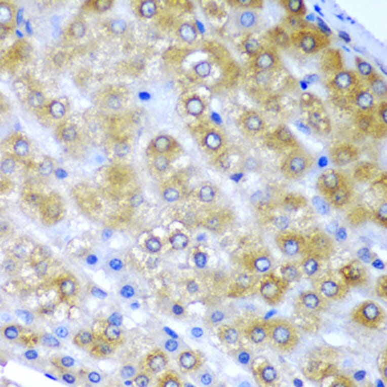 Immunohistochemistry - Anti-BMF Antibody (A12907) - Antibodies.com