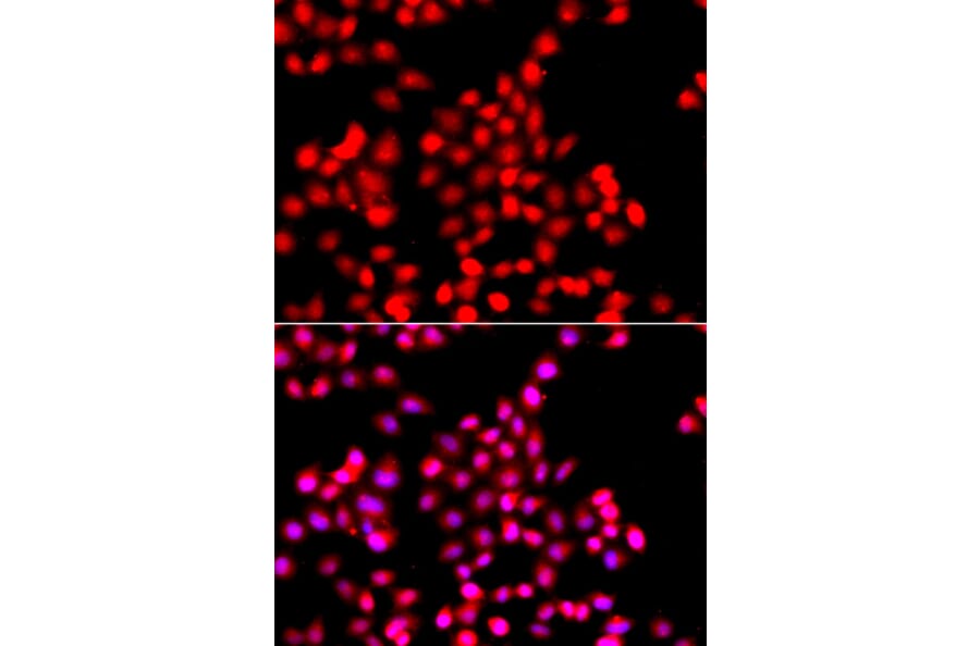 Immunofluorescence - Anti-TTBK2 Antibody (A13448) - Antibodies.com