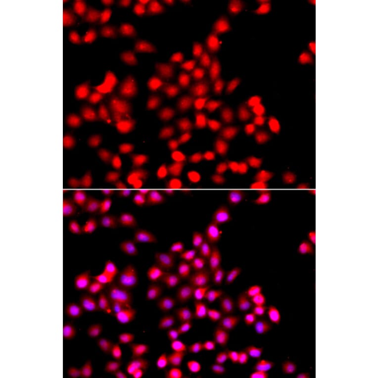 Immunofluorescence - Anti-TTBK2 Antibody (A13448) - Antibodies.com