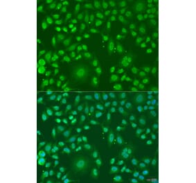 Immunofluorescence - Anti-ARL6 Antibody (A91980) - Antibodies.com