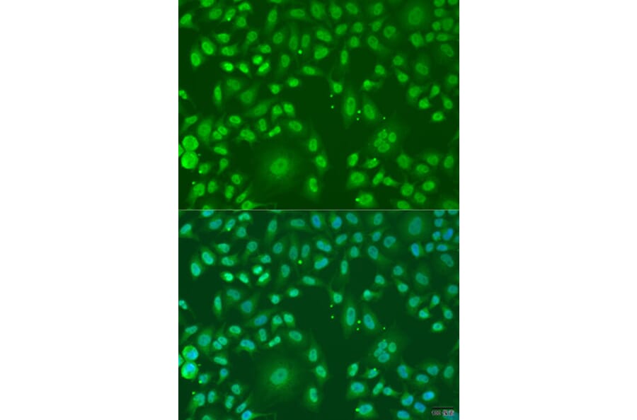Immunofluorescence - Anti-ARL6 Antibody (A91980) - Antibodies.com
