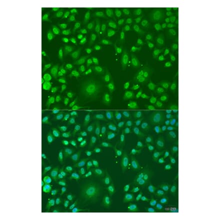 Immunofluorescence - Anti-ARL6 Antibody (A91980) - Antibodies.com