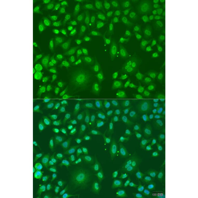Immunofluorescence - Anti-ARL6 Antibody (A91980) - Antibodies.com