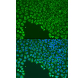 Immunofluorescence - Anti-Cdc42 Antibody (A91981) - Antibodies.com