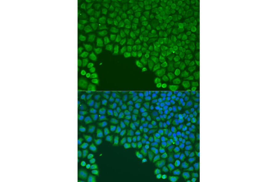Immunofluorescence - Anti-Cdc42 Antibody (A91981) - Antibodies.com
