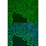 Immunofluorescence - Anti-Cdc42 Antibody (A91981) - Antibodies.com