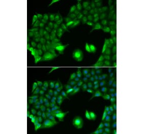 Immunofluorescence - Anti-SSX2 Antibody (A91982) - Antibodies.com