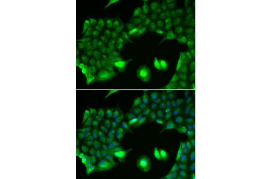 Immunofluorescence - Anti-SSX2 Antibody (A91982) - Antibodies.com