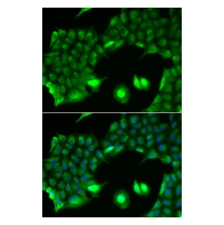 Immunofluorescence - Anti-SSX2 Antibody (A91982) - Antibodies.com