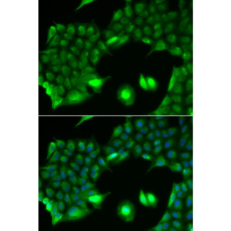 Immunofluorescence - Anti-SSX2 Antibody (A91982) - Antibodies.com