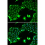 Immunofluorescence - Anti-SSX2 Antibody (A91982) - Antibodies.com