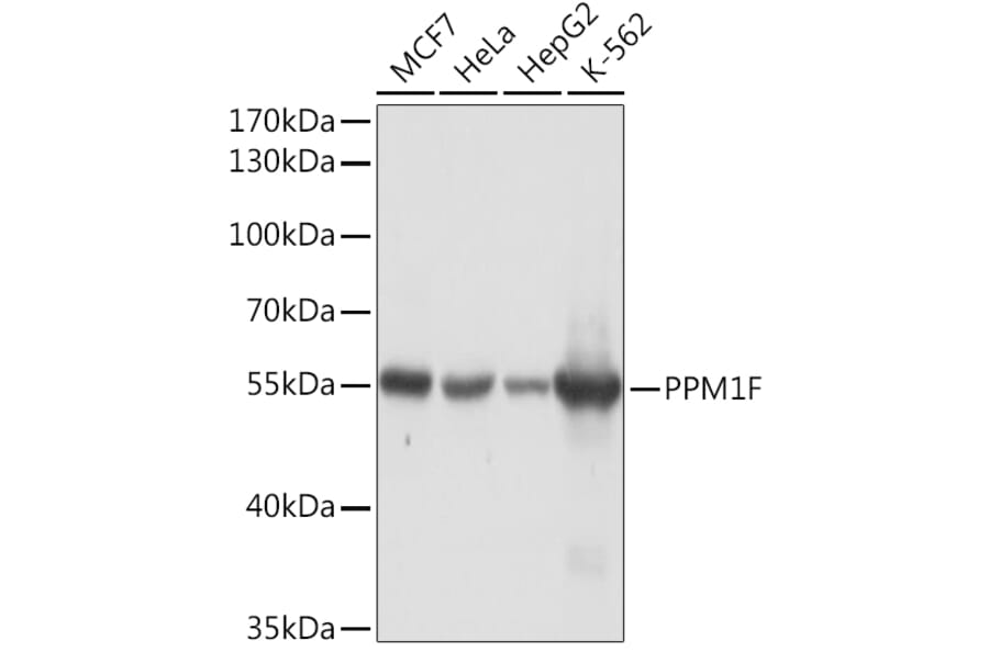 Western Blot - Anti-PPM1F/POPX2 Antibody (A91984) - Antibodies.com