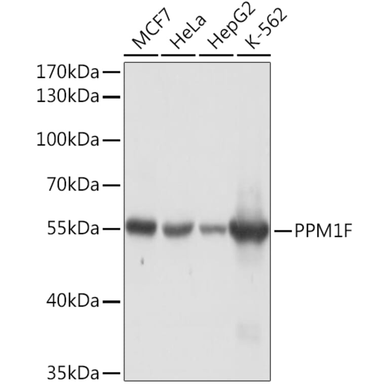 Western Blot - Anti-PPM1F/POPX2 Antibody (A91984) - Antibodies.com
