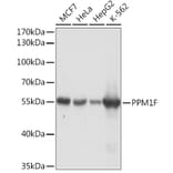 Western Blot - Anti-PPM1F/POPX2 Antibody (A91984) - Antibodies.com