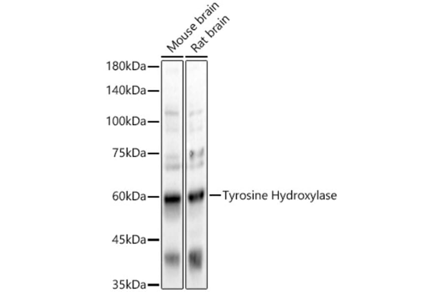 Western Blot - Anti-Tyrosine Hydroxylase Antibody (A91986) - Antibodies.com