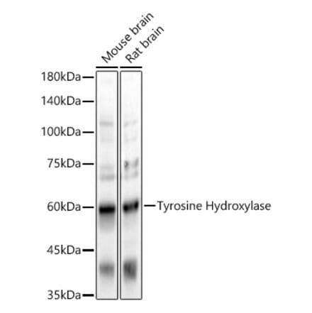 Western Blot - Anti-Tyrosine Hydroxylase Antibody (A91986) - Antibodies.com