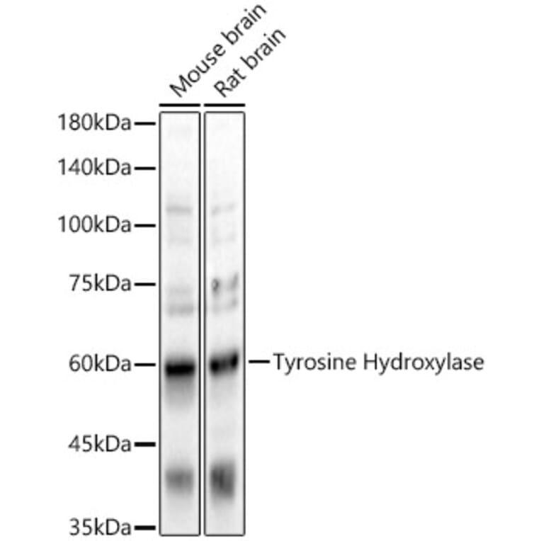 Western Blot - Anti-Tyrosine Hydroxylase Antibody (A91986) - Antibodies.com