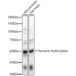 Western Blot - Anti-Tyrosine Hydroxylase Antibody (A91986) - Antibodies.com
