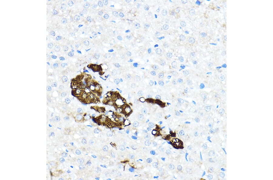 Immunohistochemistry - Anti-Tyrosine Hydroxylase Antibody (A91986) - Antibodies.com