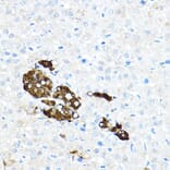 Immunohistochemistry - Anti-Tyrosine Hydroxylase Antibody (A91986) - Antibodies.com
