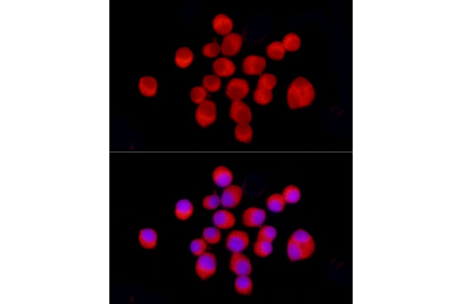 Immunofluorescence - Anti-Tyrosine Hydroxylase Antibody (A91986) - Antibodies.com