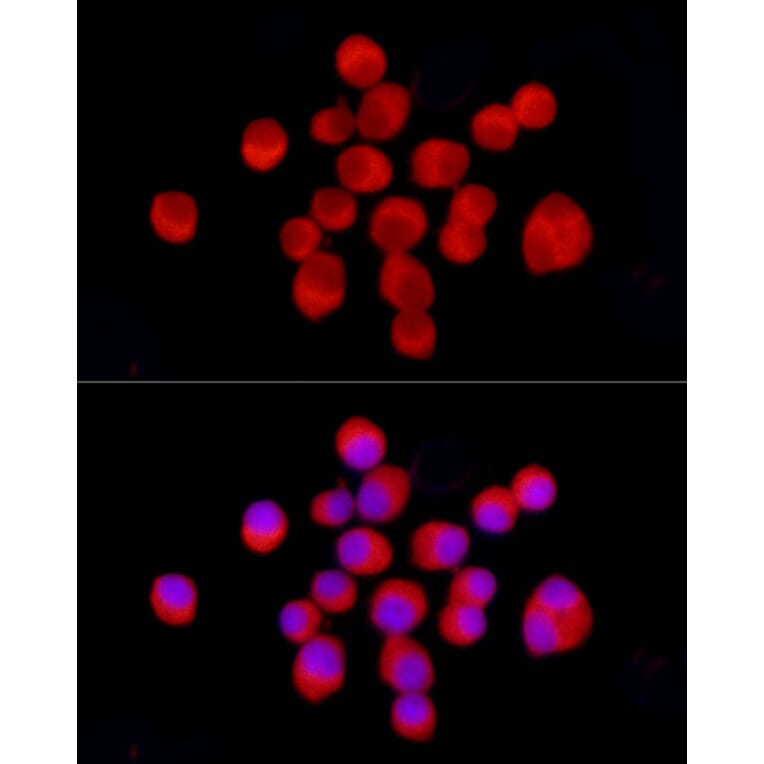 Immunofluorescence - Anti-Tyrosine Hydroxylase Antibody (A91986) - Antibodies.com