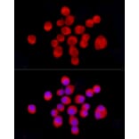 Immunofluorescence - Anti-Tyrosine Hydroxylase Antibody (A91986) - Antibodies.com