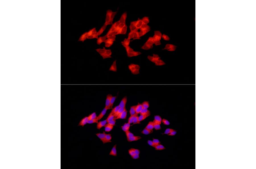 Immunofluorescence - Anti-Tyrosine Hydroxylase Antibody (A91986) - Antibodies.com