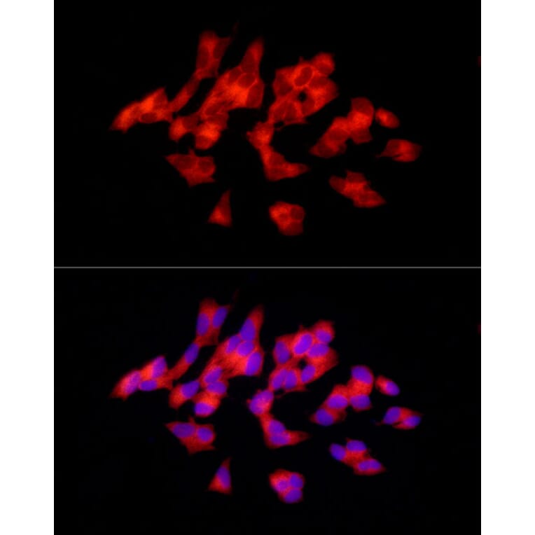 Immunofluorescence - Anti-Tyrosine Hydroxylase Antibody (A91986) - Antibodies.com