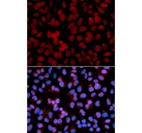 Immunofluorescence - Anti-TNFAIP3 Antibody (A91987) - Antibodies.com