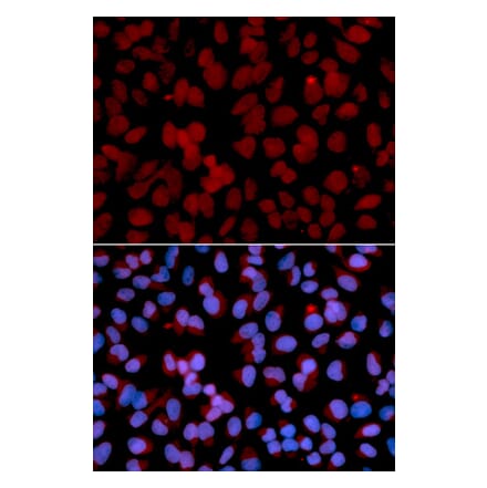 Immunofluorescence - Anti-TNFAIP3 Antibody (A91987) - Antibodies.com