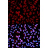 Immunofluorescence - Anti-TNFAIP3 Antibody (A91987) - Antibodies.com