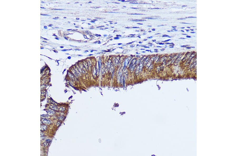Immunohistochemistry - Anti-RhoA Antibody (A91988) - Antibodies.com
