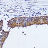 Immunohistochemistry - Anti-RhoA Antibody (A91988) - Antibodies.com