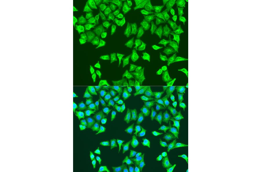 Immunofluorescence - Anti-RhoA Antibody (A91988) - Antibodies.com